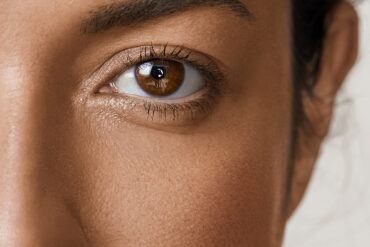 About Face A-Zyme peel