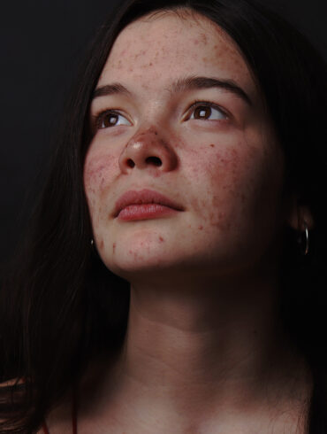 Megan Bagshaw
