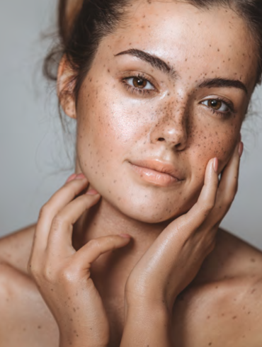 healthy skin
