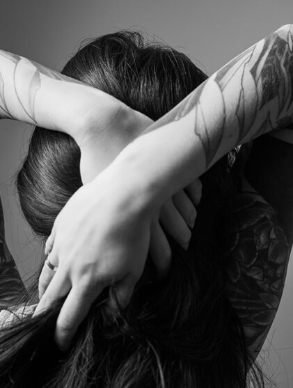 tattoo removal