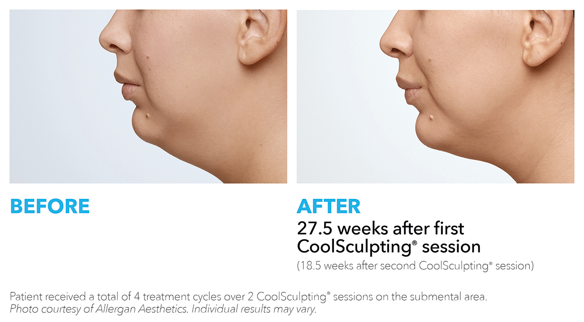 prescription skincare