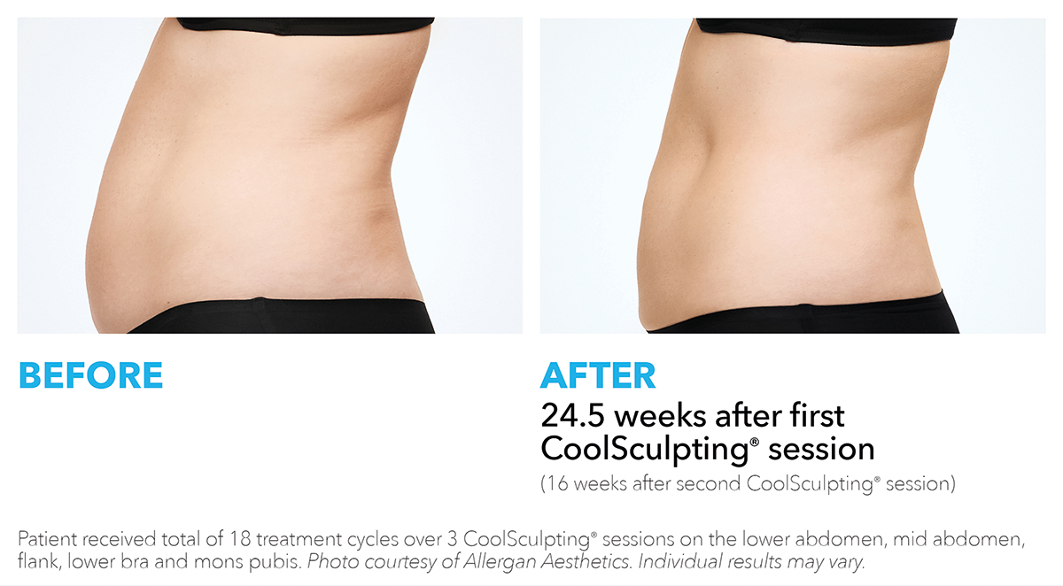 prescription skincare