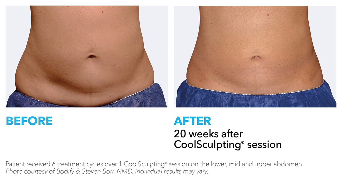 prescription skincare