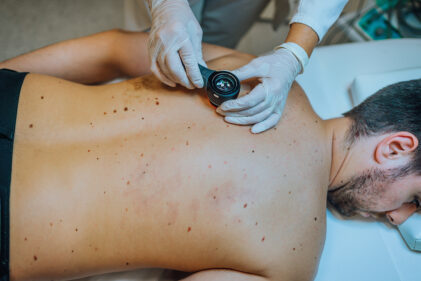 skin institute - skin cancer