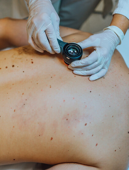 skin institute - skin cancer