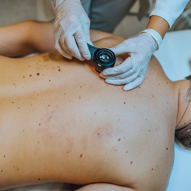 skin institute - skin cancer