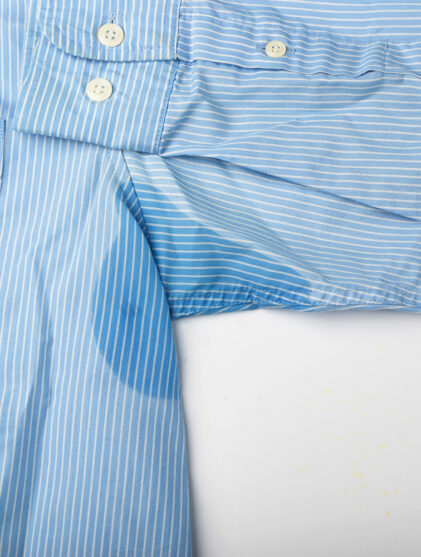 Hyperhidrosis Treatment