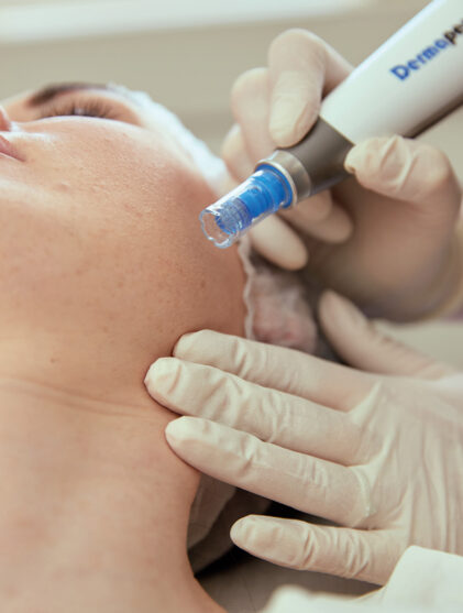 clinic 42 skin needling