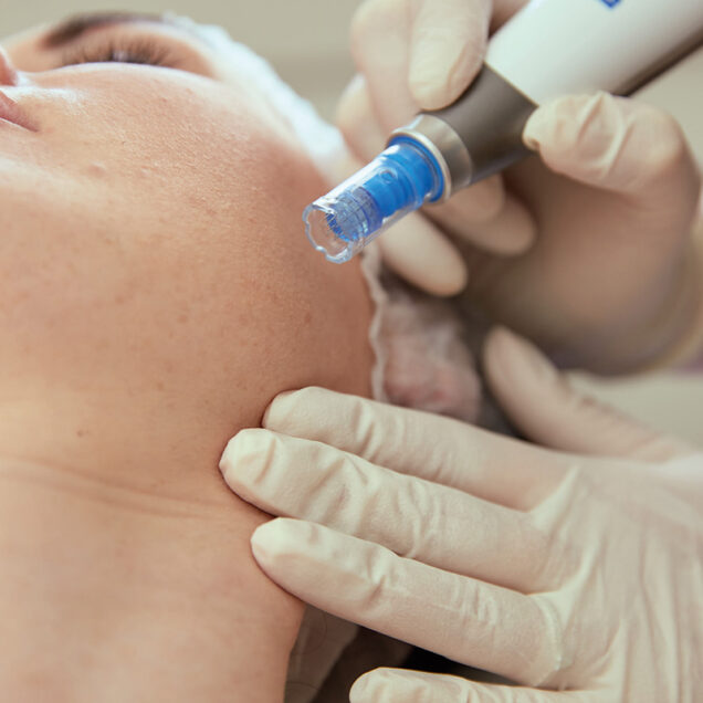 clinic 42 skin needling